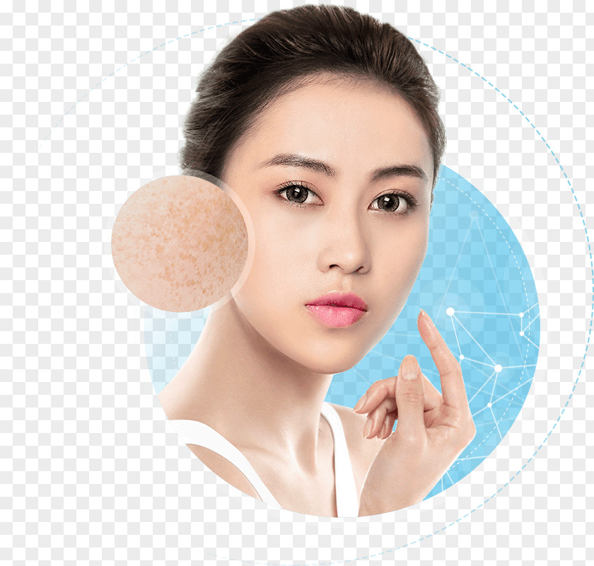 Laser Peel Side Effects 살롱 하츠 Skin Hair Ultraviolet Radiation Exposure Eyebrow PNG