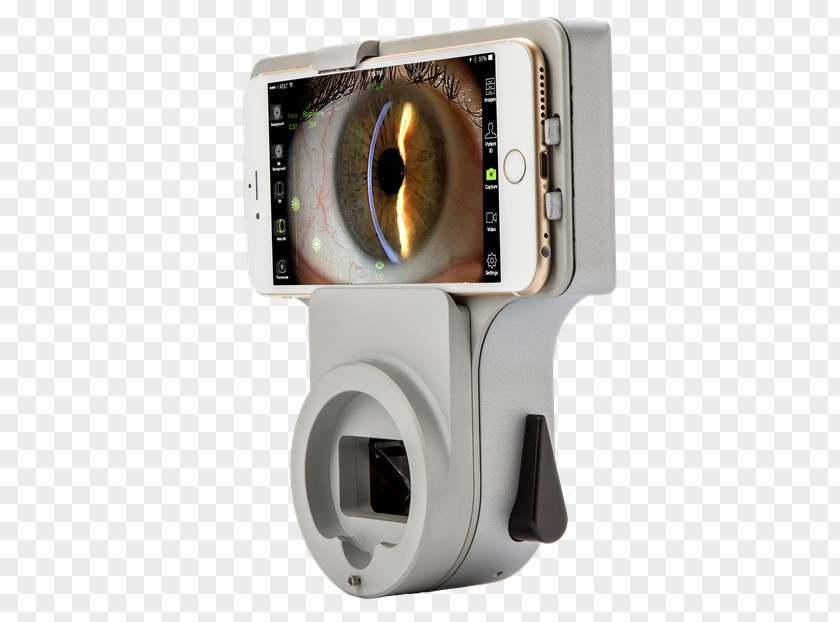 Slit Lamp Exam Image-forming Optical System Medical Imaging Technology PNG