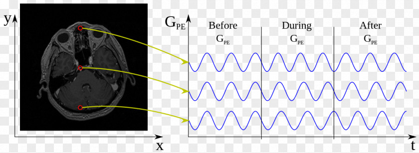 Physics Of Magnetic Resonance Imaging Wikimedia Commons Phase Angle PNG