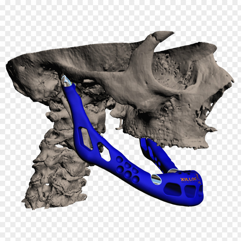Bones Applications Of 3D Printing Jaw Mandible PNG