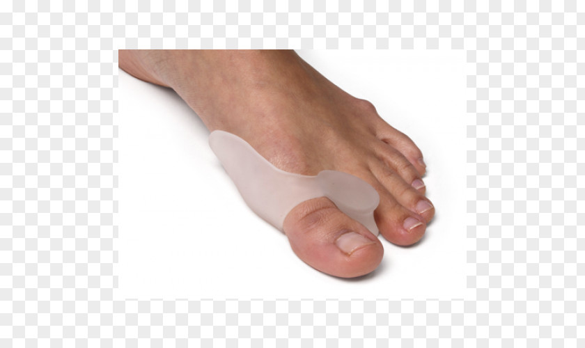 Physical Therapy Of Tcm Bunion Toe Hallux Rigidus Foot PNG