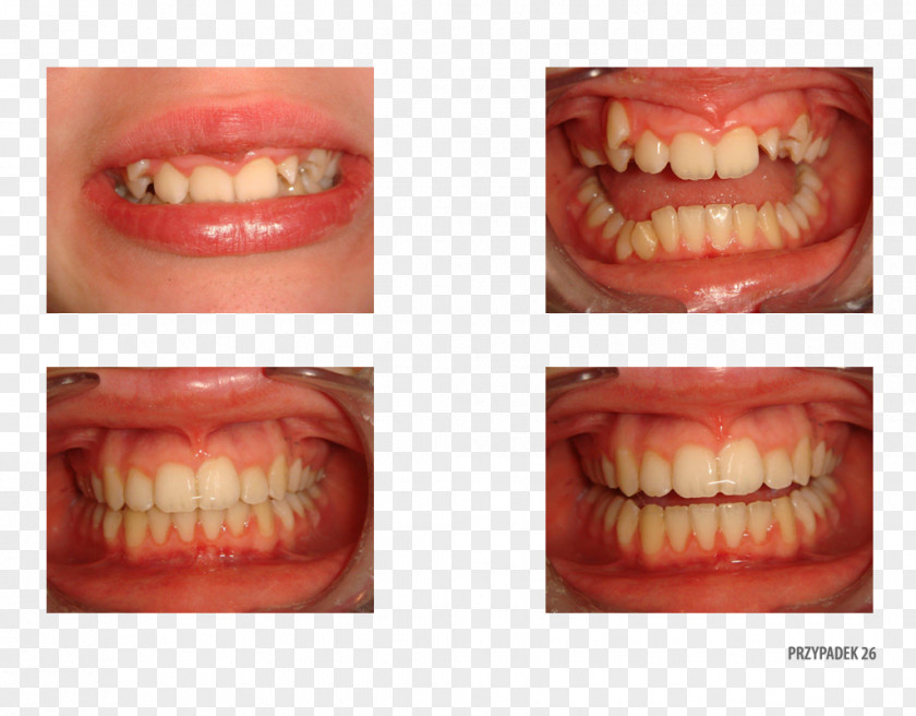 Orange Tooth Polska Close-up Therapy PNG