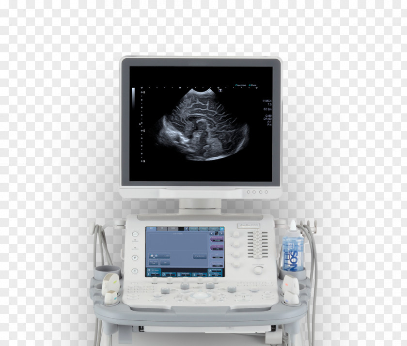 Ultrasound Ultrasonography Medicine Medical Diagnosis Surgery PNG