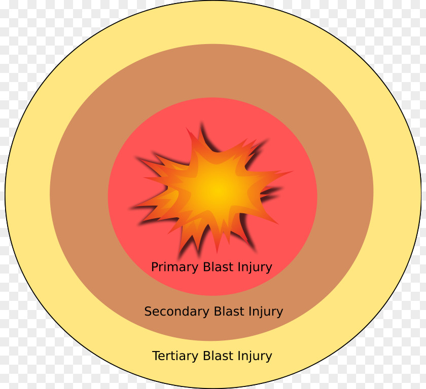 Anatomy Explosion Blast Injury Explosive Material Wave PNG