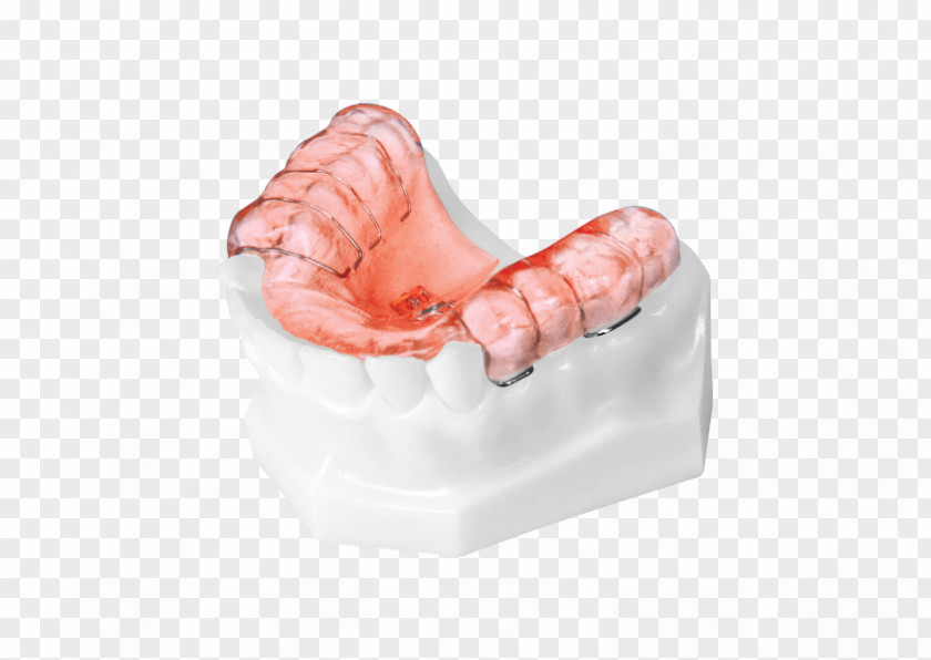 Orthodontic Correction Tooth Orthodontics Home Appliance Technology Product Design PNG