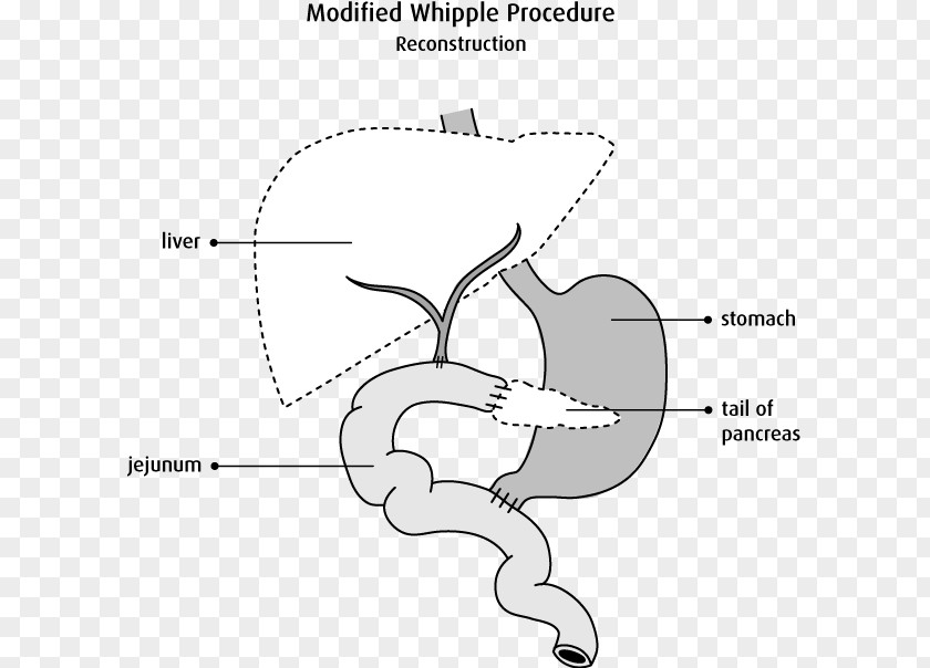 Pancreas Cells Pancreatic Juices Ear Product Design Finger Jaw PNG