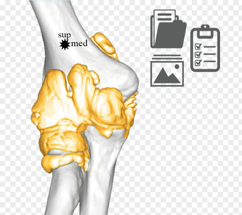 Glissement Thumb Ulnar Nerve Elbow Joint Humerus PNG