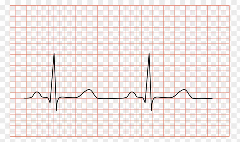 Heart Electrocardiography Electrocardiogram Cardiology Medicine PNG