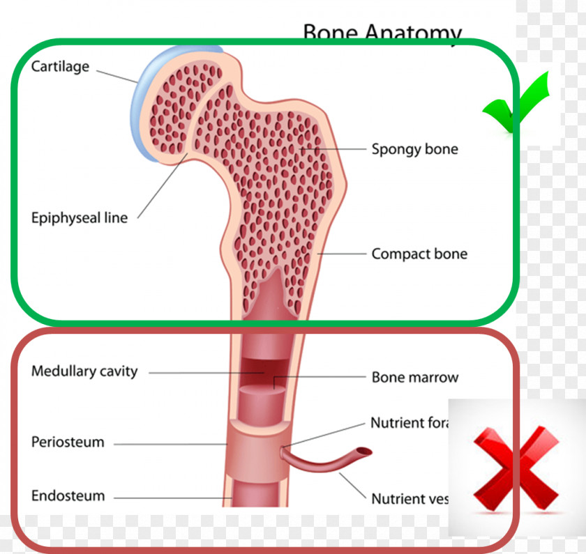 Skeleton Microfracture Surgery Human Bone Knee PNG