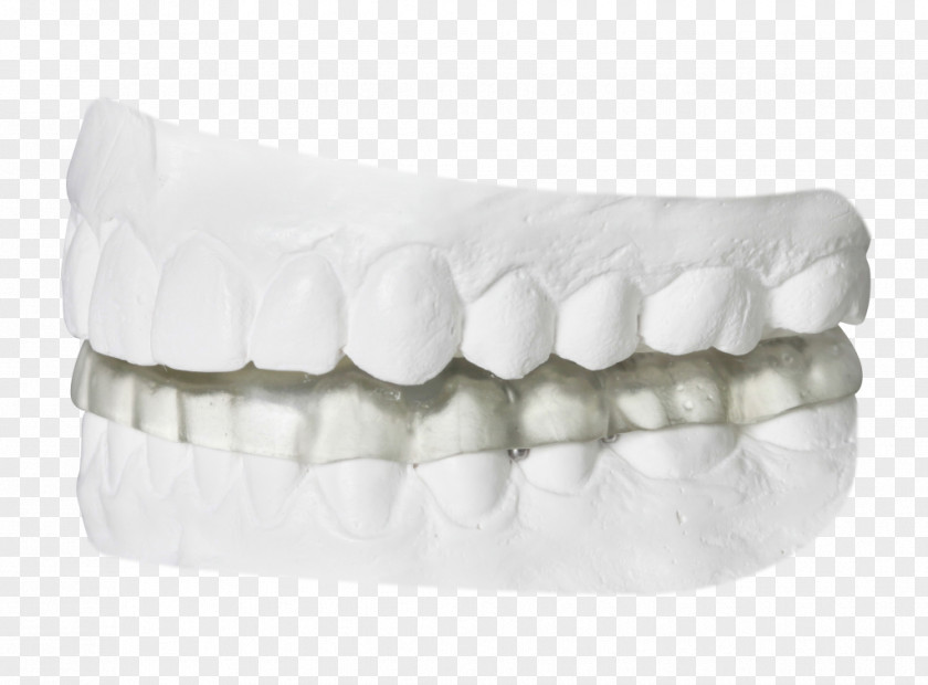 Temporomandibular Joint Dysfunction Splint Dentist Orthodontics PNG