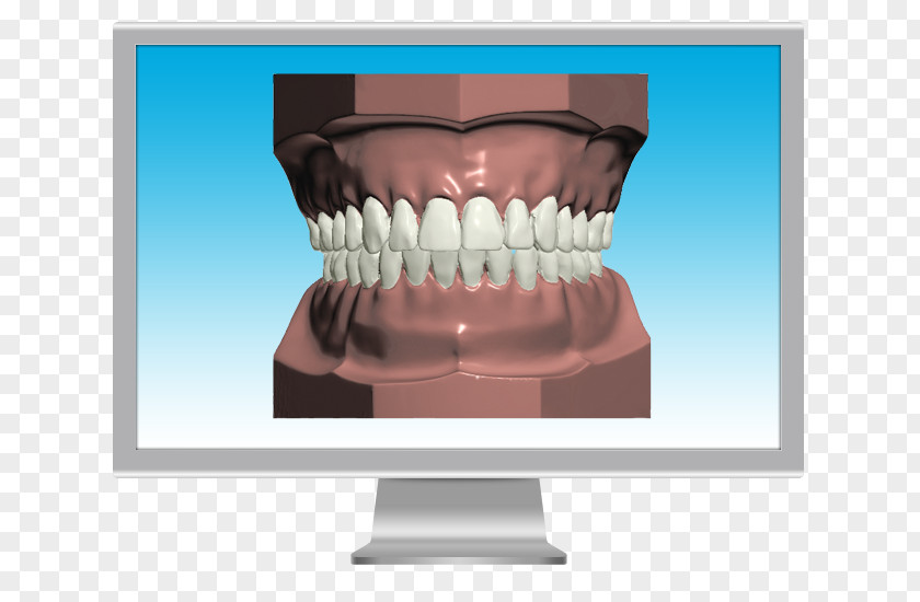 Dental Health Restoration Chart Human Tooth Jaw Mandible Animal Bite PNG
