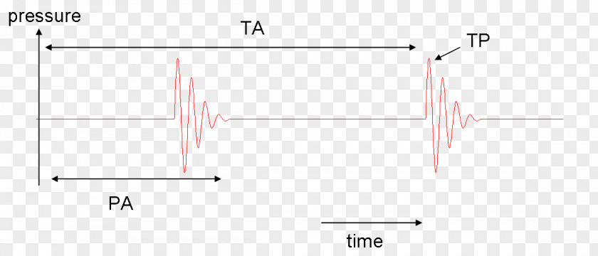 Line Point Angle PNG