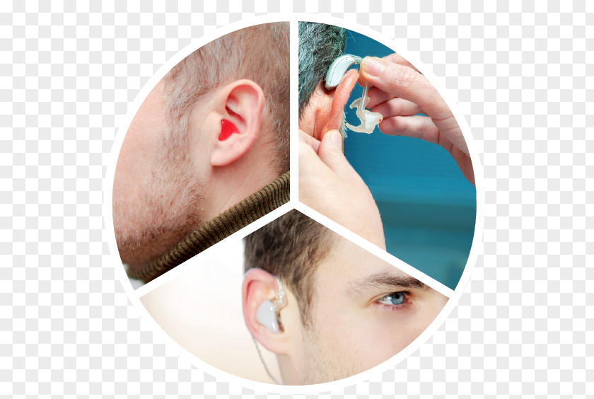 Ear Endoscopic Surgery Hearing Middle Inner PNG
