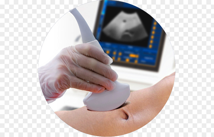 Pregnancy Ultrasonography Ultrasound Interventional Radiology Medicine PNG