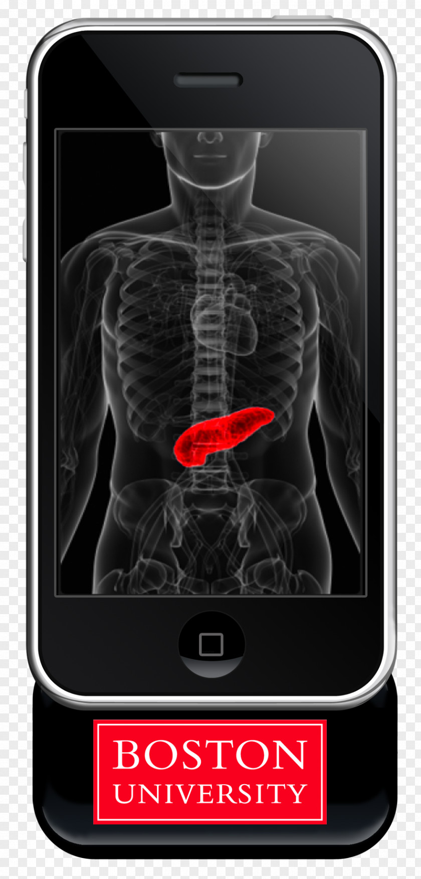Health Diabetes Mellitus Kidney Failure Pancreas Insulin PNG