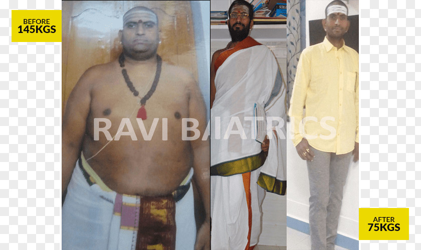 Andhra Ratna Road Shoulder Outerwear Abdomen PNG