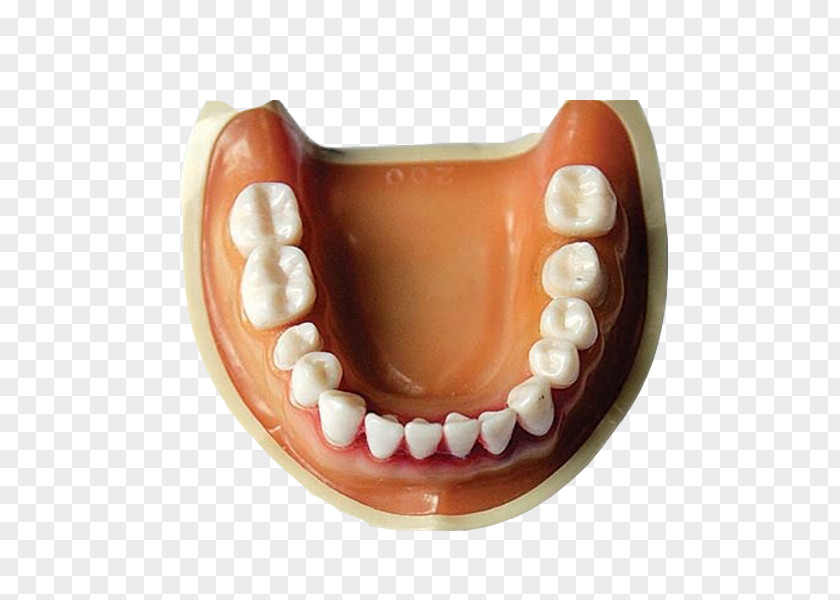 Free Dentures Pull Material Tooth Mouth Prototype Crown PNG