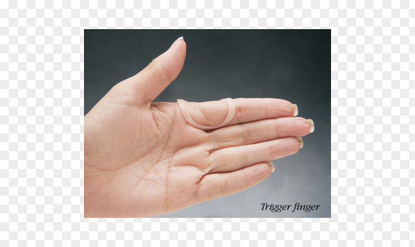 Trigger Thumb Splint Mallet Finger Boutonniere Deformity Swan Neck PNG