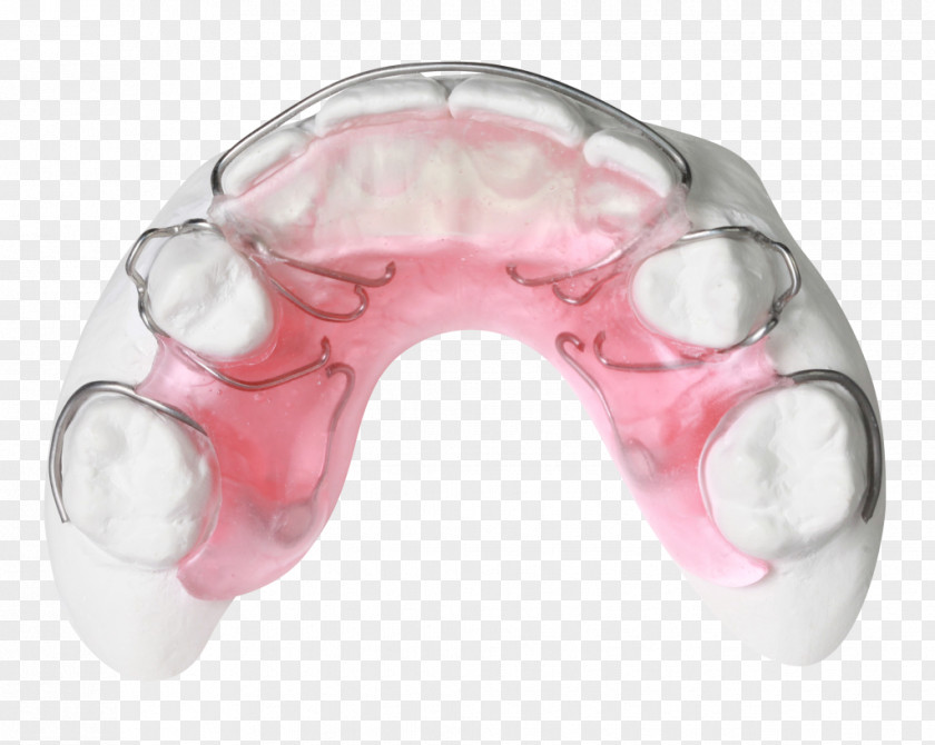 Gergen's Orthodontic Lab Technology Gergens Orthodontics Bionator PNG