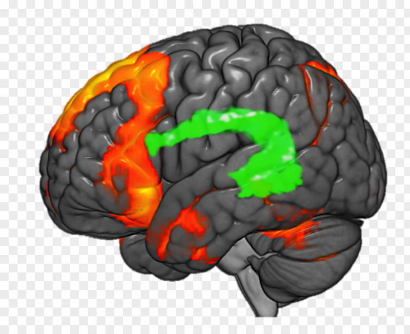 Brain Functional Magnetic Resonance Imaging Epilepsy Neuroimaging PNG