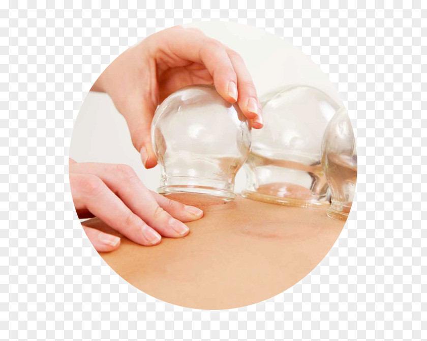 Cupping Therapy Bekam Medicine Massage PNG