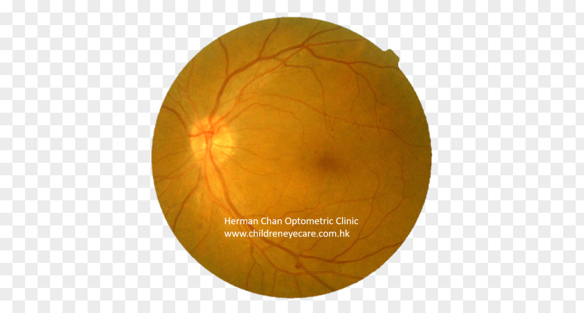 Eye Care Sphere PNG