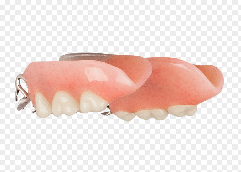 Aspen Dental Tooth Removable Partial Denture Dentures Dentistry PNG