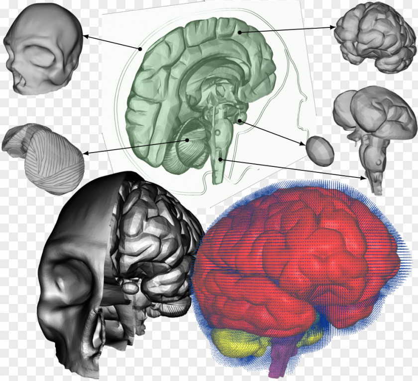 Brain Traumatic Injury Concussion Amnesia Neurosurgery PNG