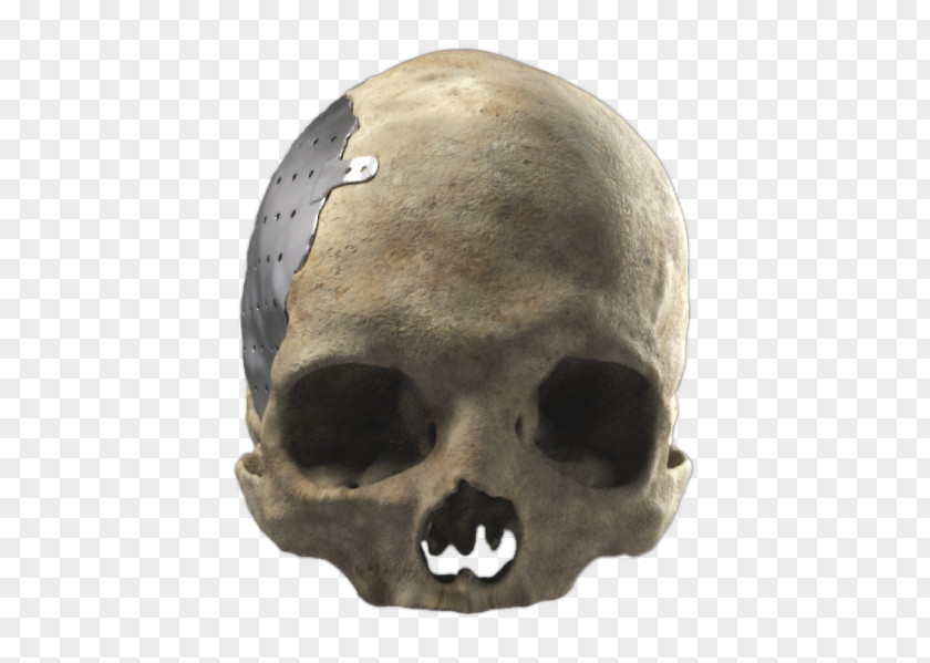 Skull Cranioplasty Poly Snout Skeleton PNG