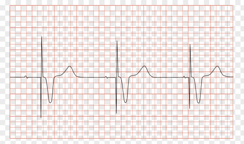 Ecg Images O’Reilly Media, Inc. Chief Executive Organization Apache Hadoop Computer Security Incident Management PNG