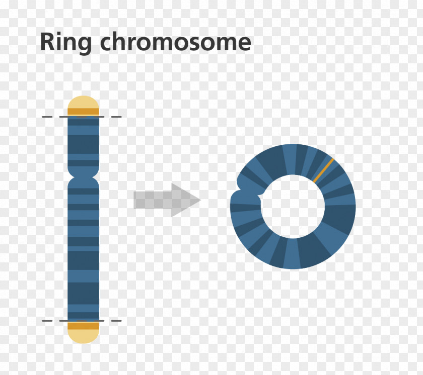 Chromosome Ring 14 Syndrome Abnormality Genetics PNG