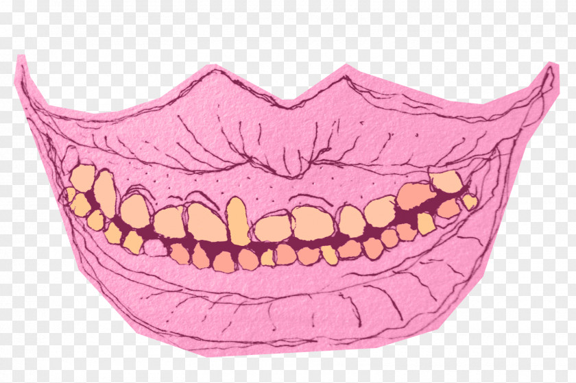 Dentes Jaw Mouth Magenta PNG