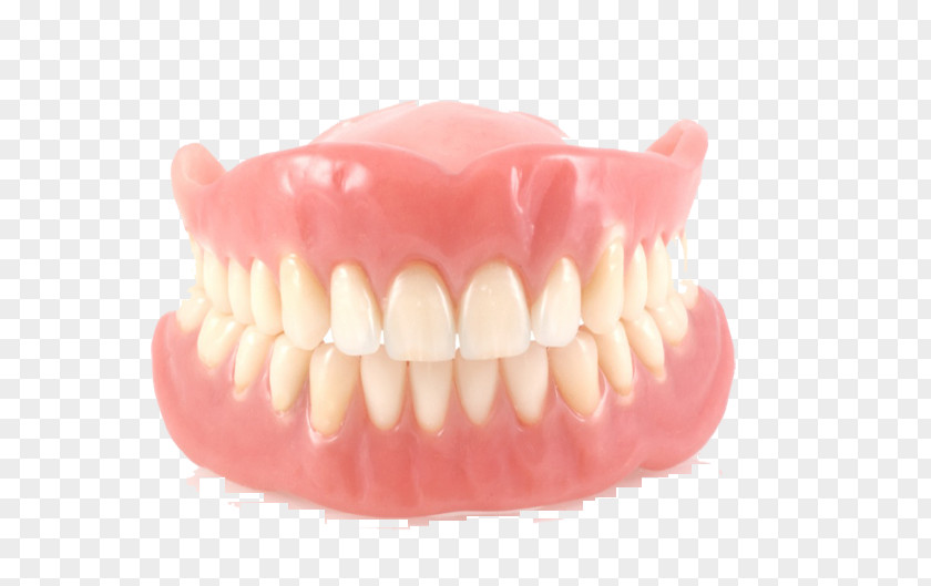 Crown Dentures Removable Partial Denture Dentistry Dental Implant Laboratory PNG