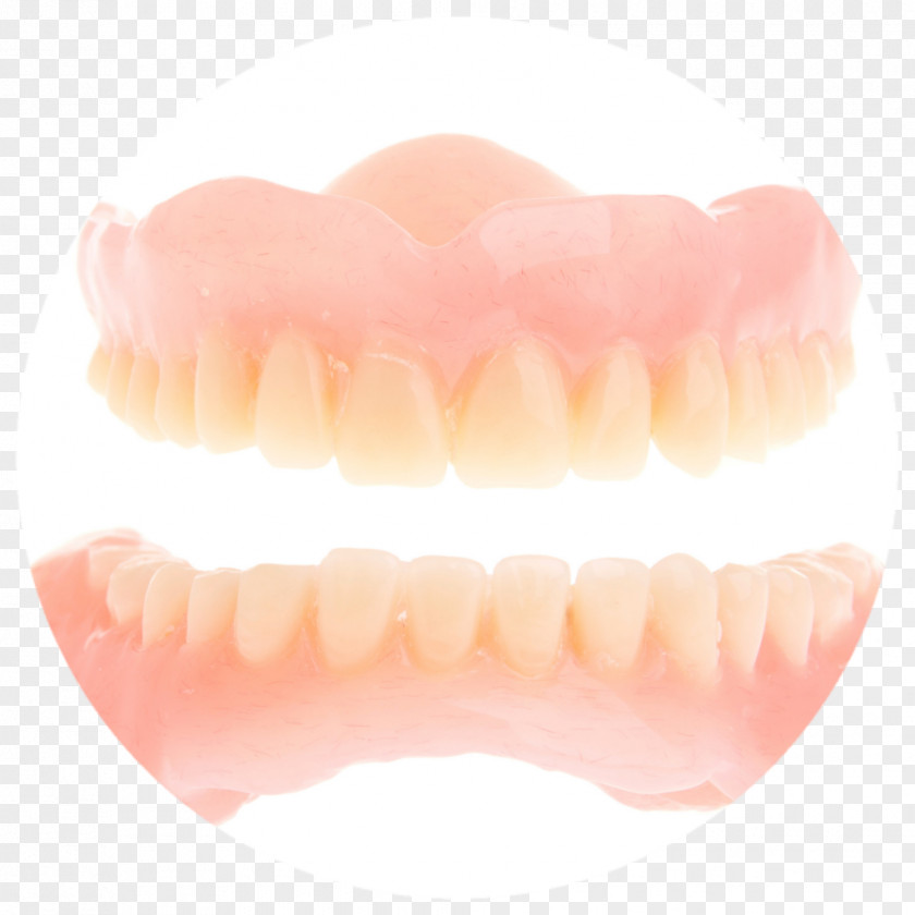 Cosmetic Dentistry Implants Human Tooth Dentures PNG