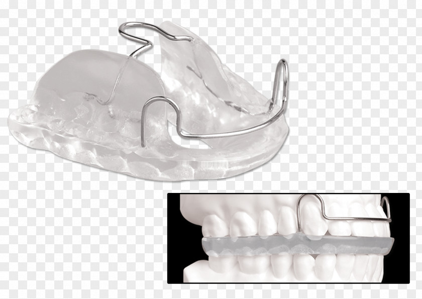 Mandibular Advancement Splints Jaw Mandible Splint Dentistry Maxilla PNG