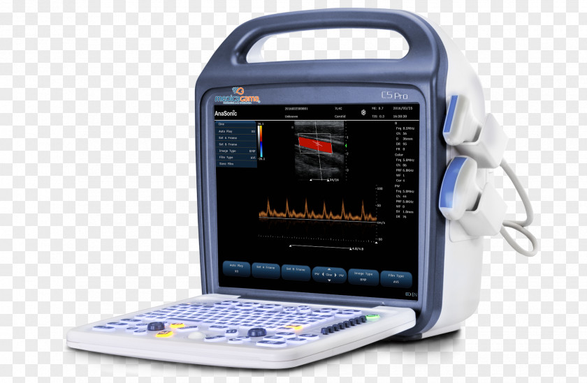 Agama Medical Equipment Doppler Ultrasonography Ultrasound Echocardiography PNG