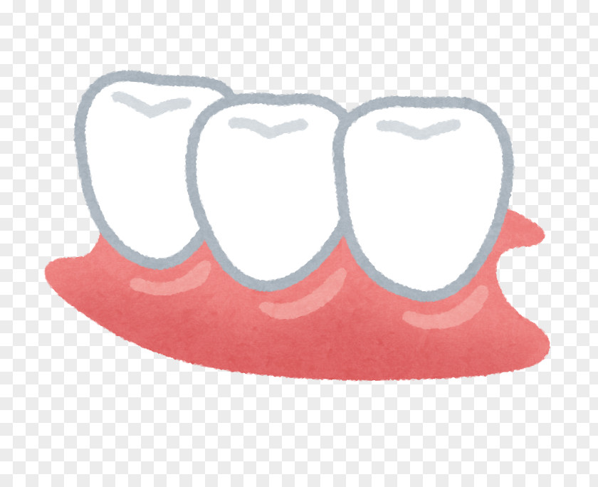 Denture Dentures Dentist Tooth Removable Partial Therapy PNG