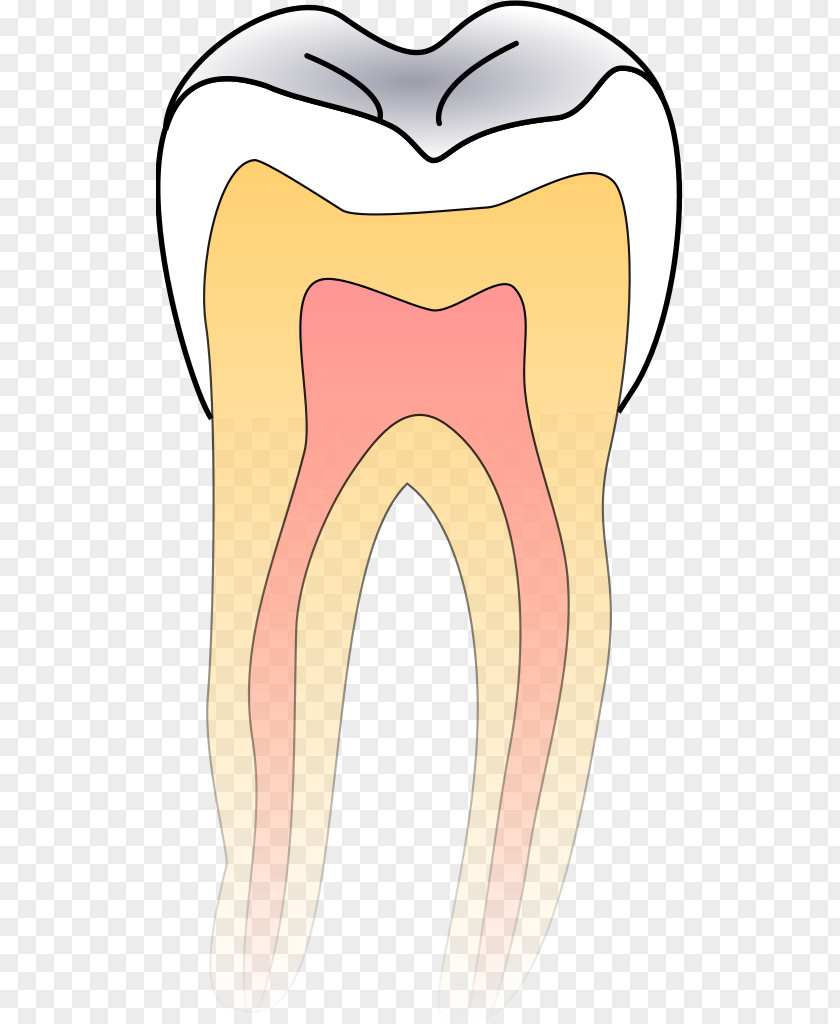 Dental Dentistry Tooth Decay PNG