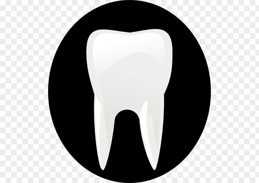Dental Surgery Pictures Tooth Free Content Molar Clip Art PNG