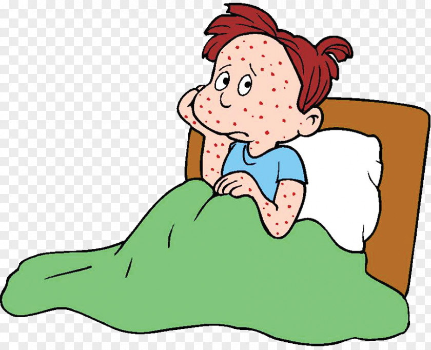 Chicken Pox Chickenpox Infection Infectious Disease Clip Art PNG
