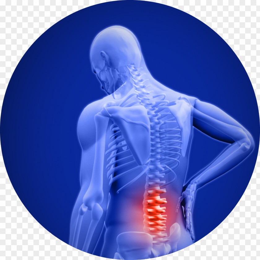 Low Back Pain Cody B. Doyle, D.C. Neck Spinal Disc Herniation PNG