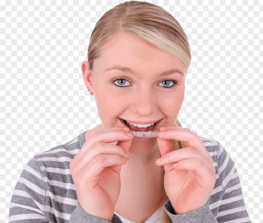 Clear Aligners Dental Braces Dentistry Tooth Orthodontics PNG