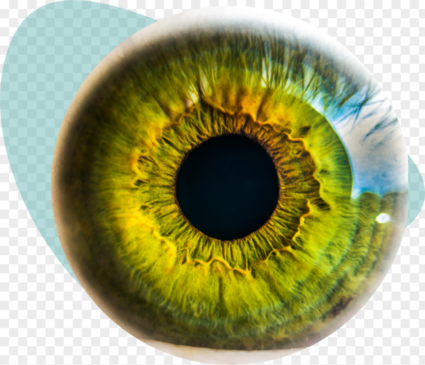 Eyeball Eye Surgery Injury LASIK Keratoconus PNG