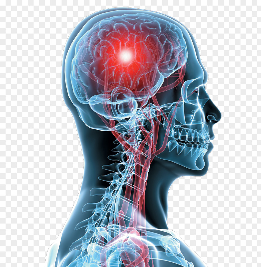 Brain Nerve Traumatic Injury Concussion Medicine PNG