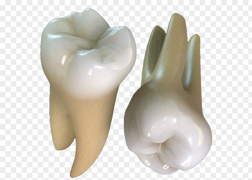 Crown Human Tooth Maxillary First Molar Decay PNG