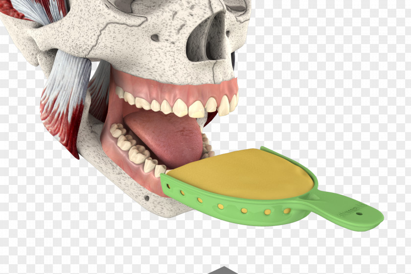 3d Tooth Repair Jaw PNG