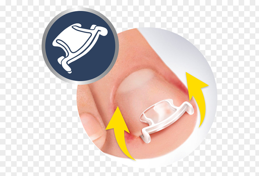Nail Onychocryptosis Toe Dr. Scholl's Shoe PNG
