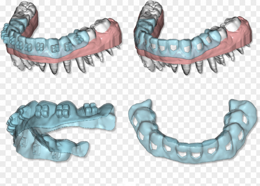 Dental Template Clear Aligners Tooth Orthodontics Dentistry 3D Scanner PNG