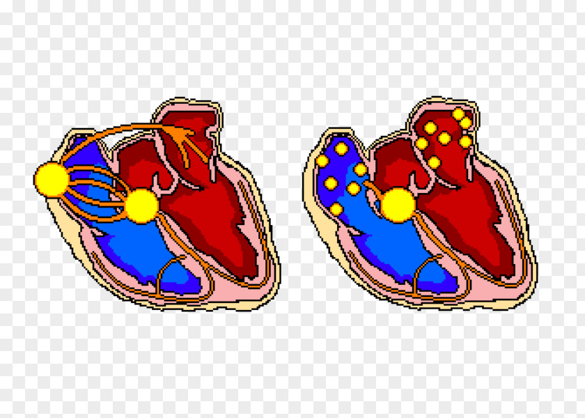Heart Atrial Fibrillation Atrium Atrioventricular Block Tachycardia PNG