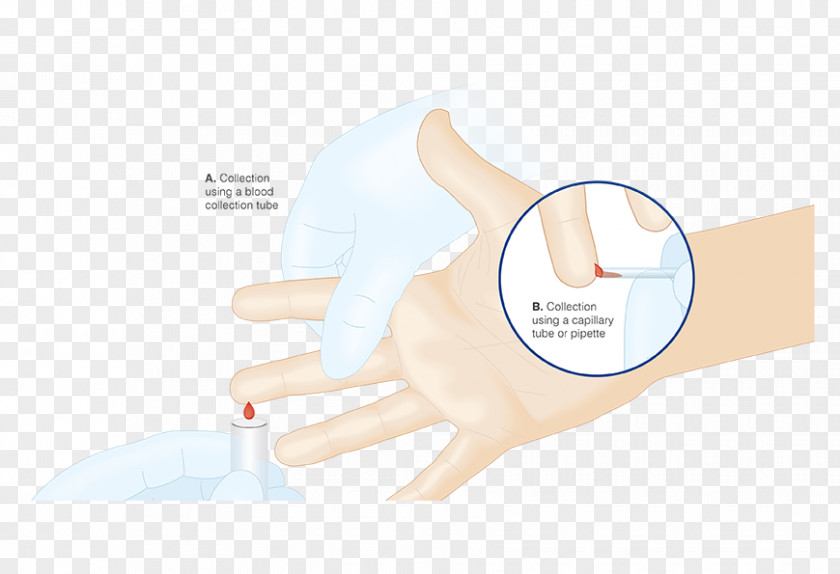 Blood Capillary Action Thumb Medical Glove Product Hand Model PNG